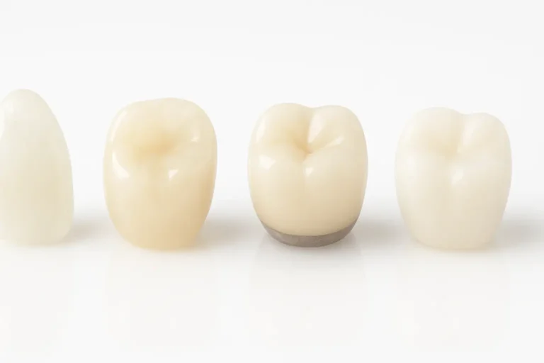 Dental Ceramics Guide: Zirconia Crowns Porcelain Veneers and Implants