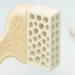 What Are Bioceramics? Medical and Dental Applications